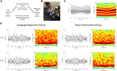 Language experience during the sensitive period narrows infants’ sensory encoding of lexical tones—Music intervention reverses it